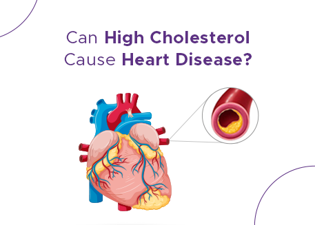 Can High Cholesterol Cause Heart Disease?